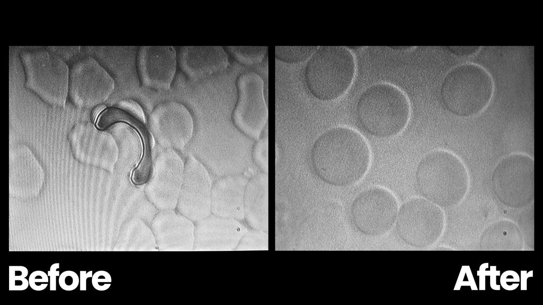 Live Blood Analysis: A Clear Before/After Shift 72 Hours After EMF Conditioning